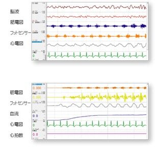 ワイヤレス生体ユニット、脳波（EEG）、筋電図（EMG）、心電図（ECG）、神経活動電位、電気生理実験、テレメータ、アクティブ電極