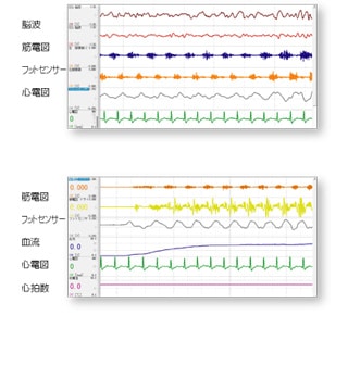 ワイヤレス生体ユニット