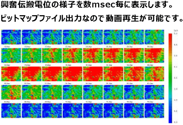 心筋マッピングシステム　興奮伝搬電位