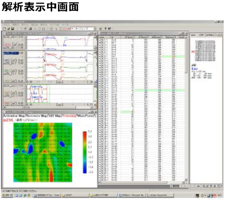 心筋マッピングシステム　解析