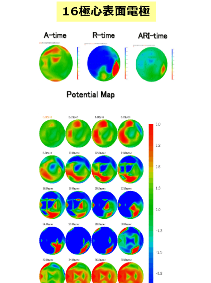 心筋マッピングシステム　16極表面電極