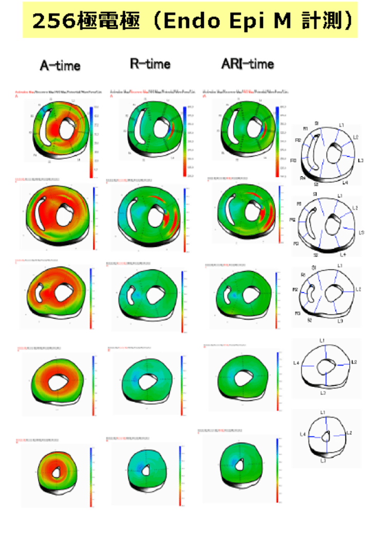 心筋マッピングシステム　256極表面電極